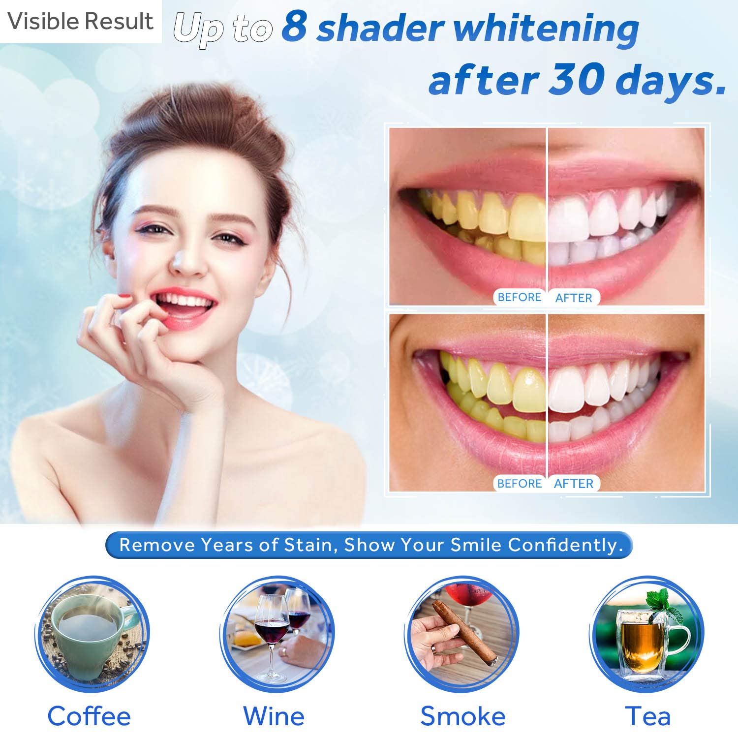 Gel Pemutih Gigi Isi Ulang Syr - Teeth Whitening With Peroxide ulasan dan harga