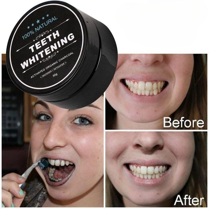 1 Kotak Bubuk Pemutih Gigi Ara - Teeth Whitening Flash ulasan dan harga