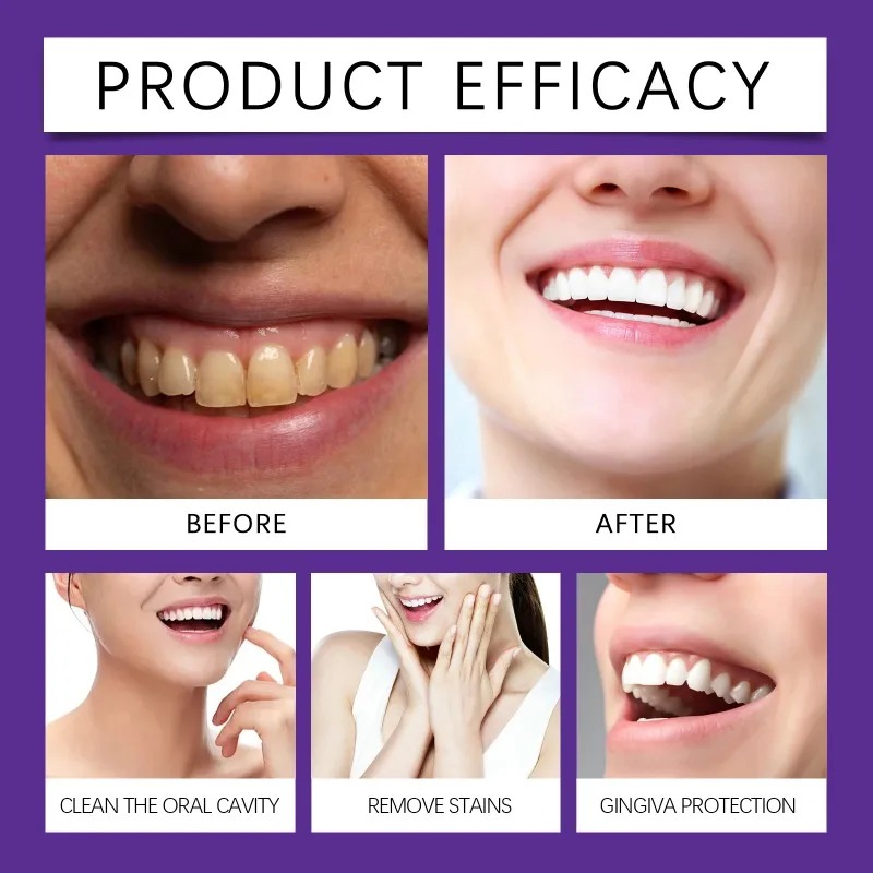 Bubuk Mineral Restorasi Gigi U - Teeth Whitening Flash ulasan dan harga