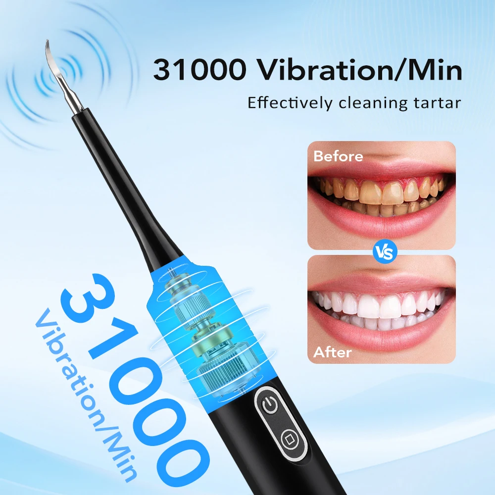 Alat Pembersih Karang Gigi Ele - Teeth Whitening Professional ulasan dan harga